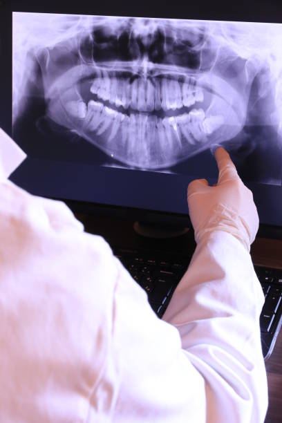 Best Emergency Dental Care for Broken or Chipped Teeth in Osceola, WI