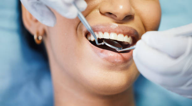 Best Emergency Denture Repair in Osceola, WI